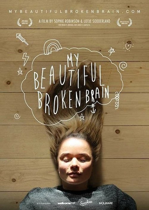 Мой прекрасный сломанный мозг / My Beautiful Broken Brain