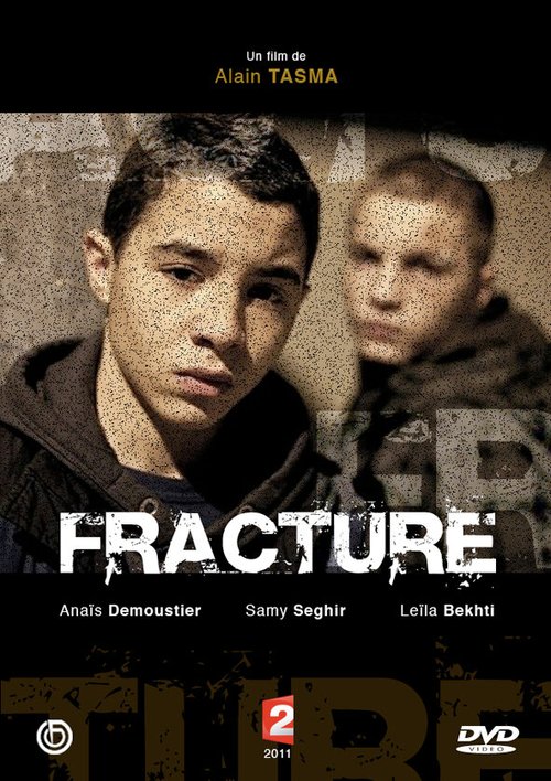 Перелом / Fracture